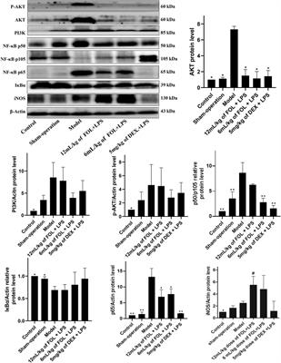 Fengreqing Oral Liquid Exerts Anti-Inflammatory Effects by Promoting Apoptosis and Inhibiting PI3K/AKT and NF-κB Signaling Pathways